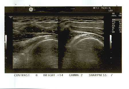 Gelenkultraschall  – Sonografie des Bewegungsapparats für Gelenke, Sehnen und Muskeln